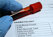 Pfizer Inc v Uniqure Biopharma BV [2024] EWHC 2672 (Pat)