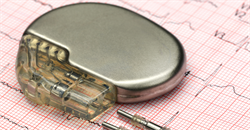 Pacemaker PTSD?