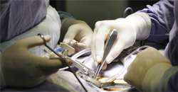 A Day in the Life of an Orthopaedic Spinal Expert Witness